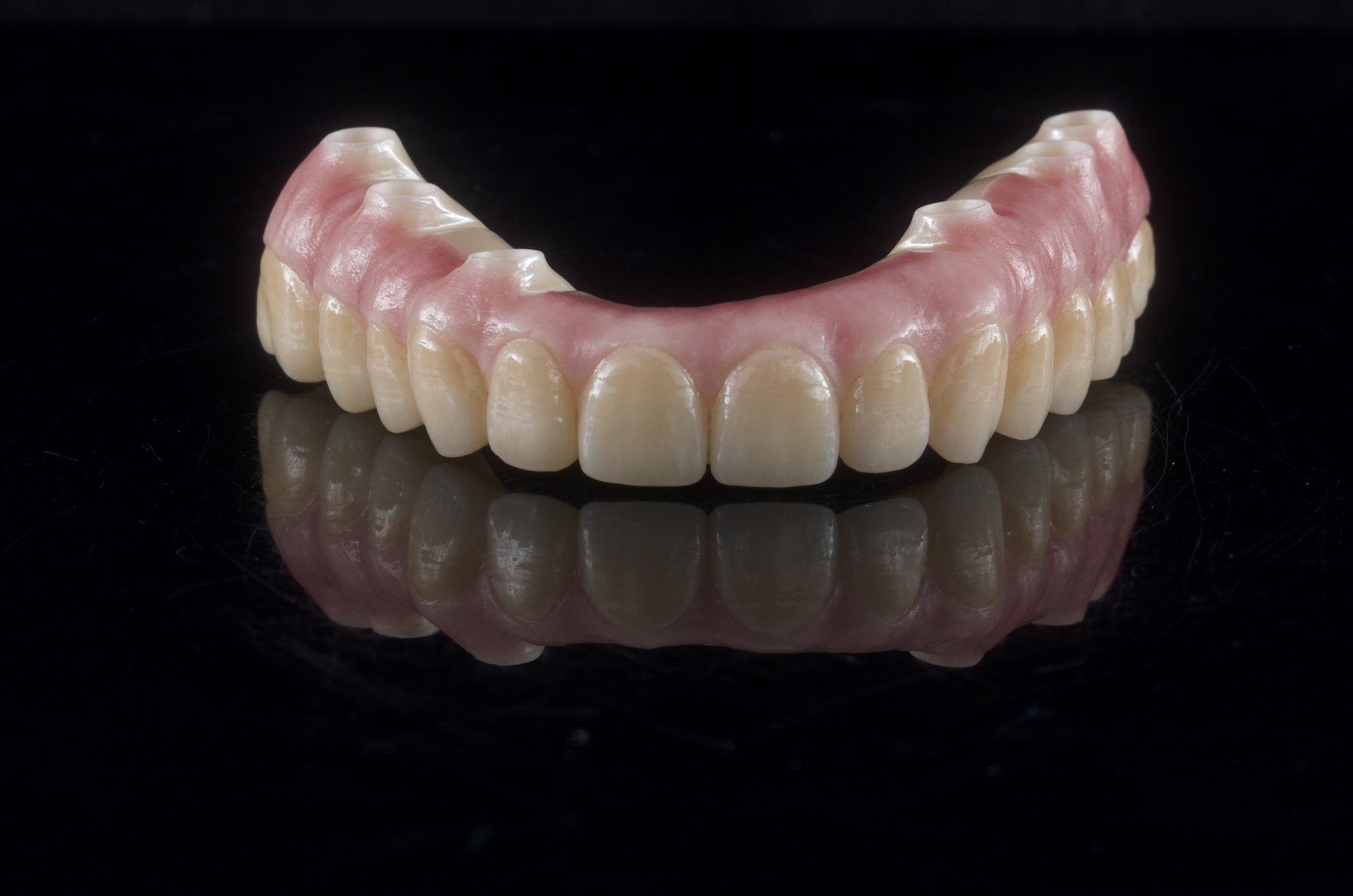 Full Contour Zirconia Bridge